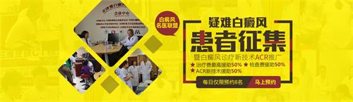 疑難白癜風(fēng)患者征集項目
