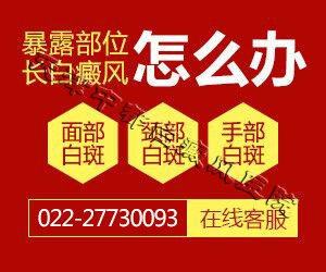 天津白癜風醫院
