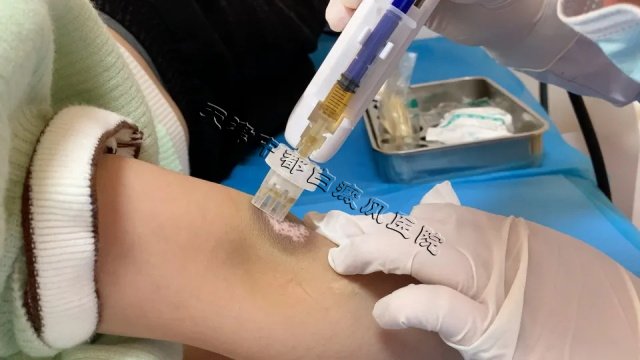 天津白癜風醫(yī)院