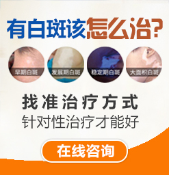 滄州白癜風(fēng)哪個(gè)醫(yī)院好？