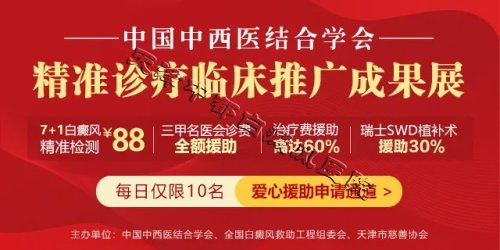 天津中都白癜風醫院